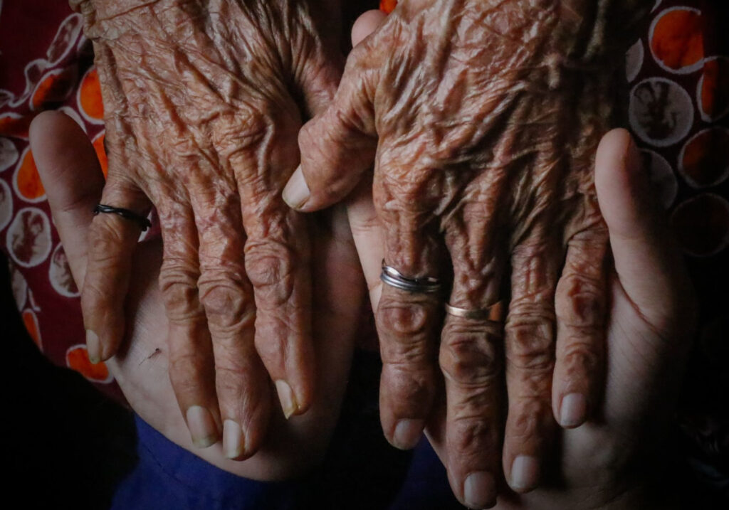 Community nursing services are struggling