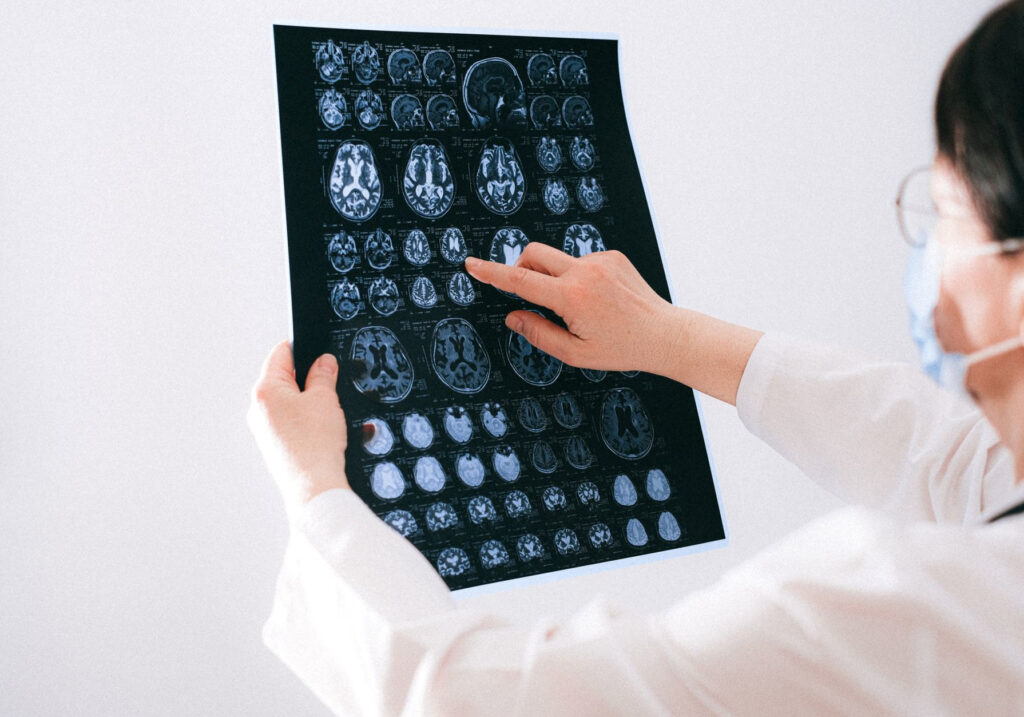 Motor Neuron Disease treatments